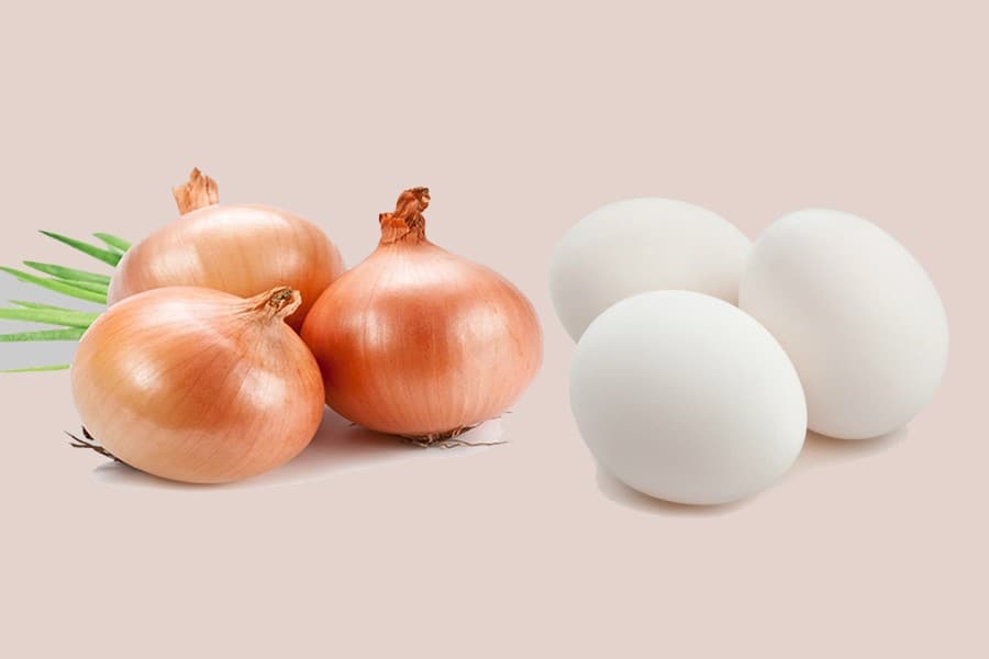Prices of egg, onion and most vegetables rise 6.0-128pc in past 3 months