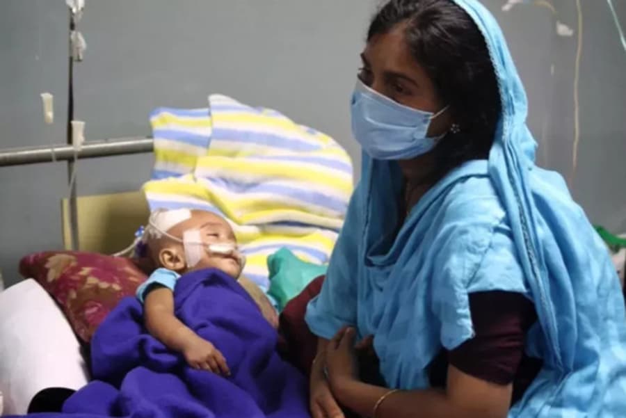 One more child dies with measles-like symptoms in Sylhet