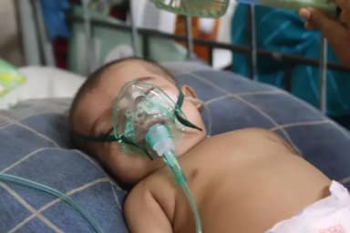 4 suspected Measles deaths raise Bangladesh toll to 820