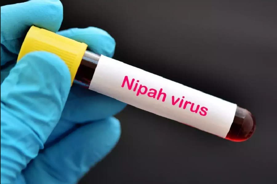 Farmer dies of Nipah virus infection in Pabna