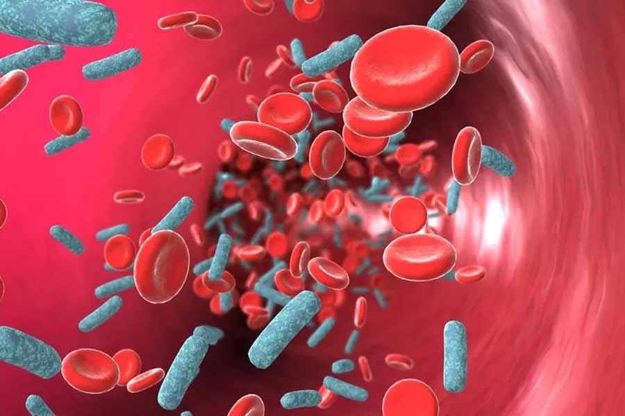 1,000 women die of infection in reproductive organs every year