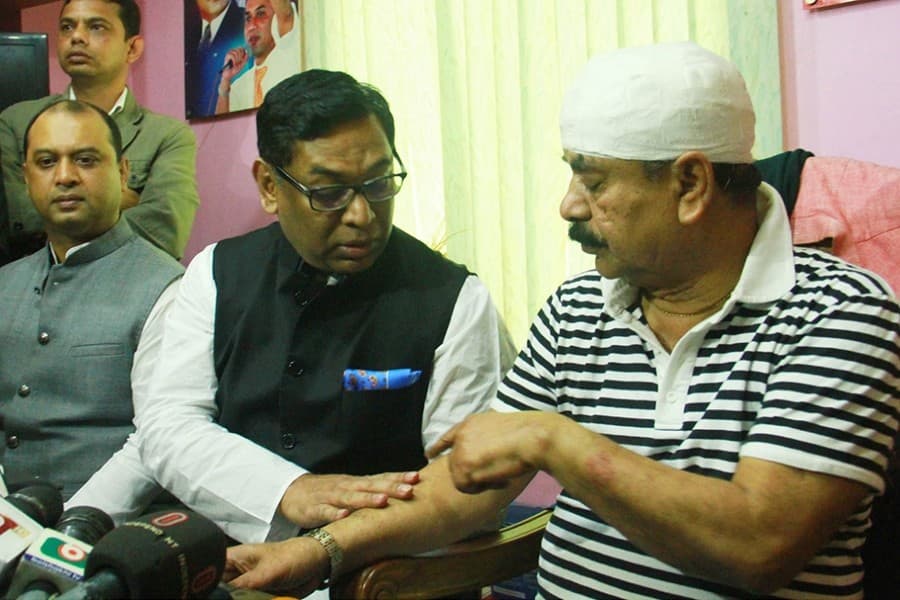 Minister Nasrul pays visit to injured Gayeshwar