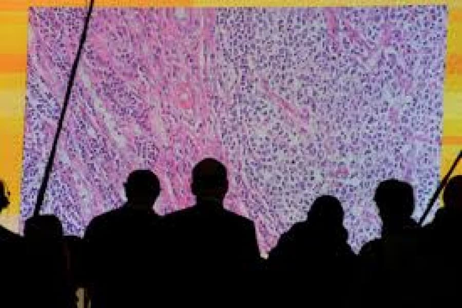 Cancer overtakes heart disease as biggest rich-world killer