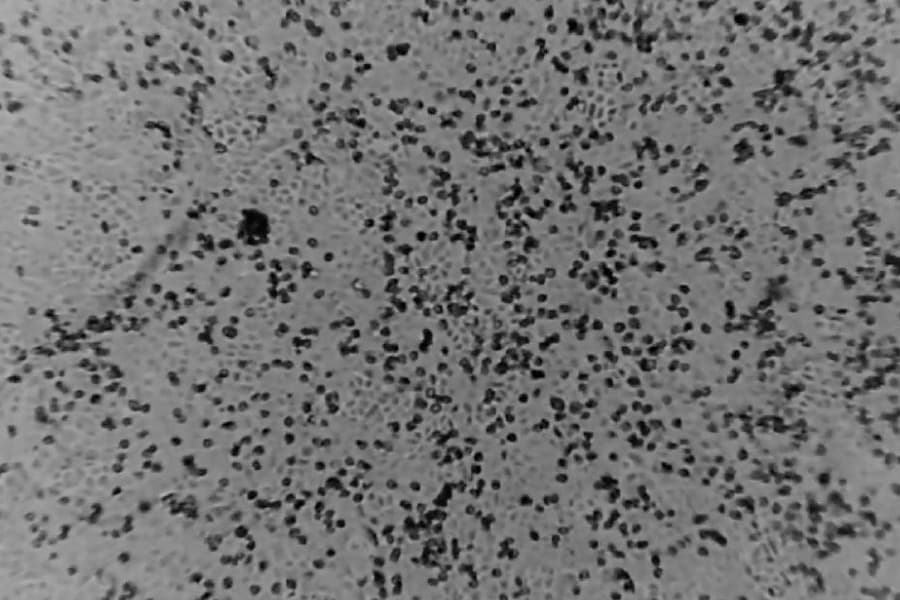 Australian scientists first to recreate Coronavirus outside China