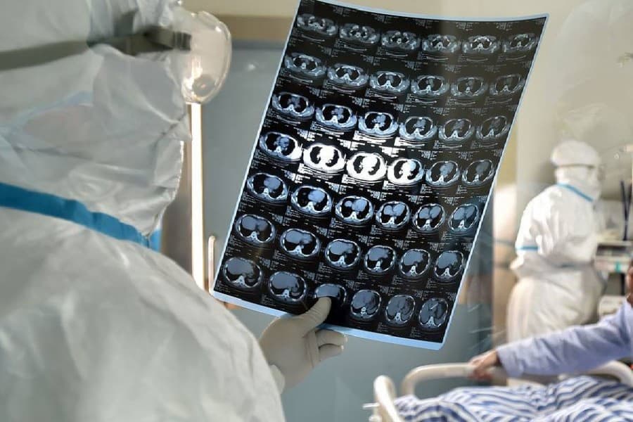 Novel coronavirus may spread via digestive system: experts