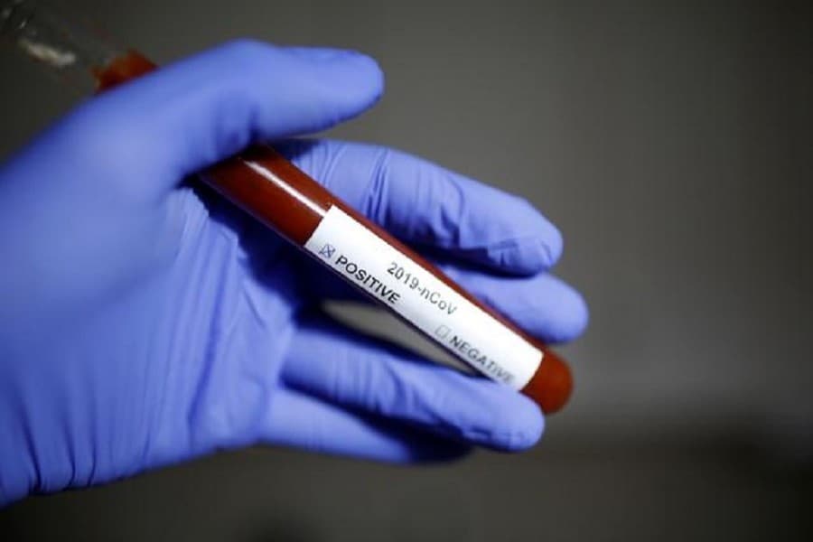 Coronavirus: Immune clue sparks treatment hope