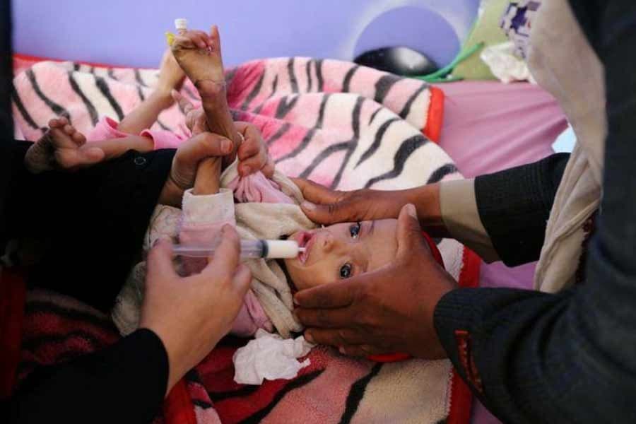 Malnutrition could claim lives of more 10,000 children per month this year