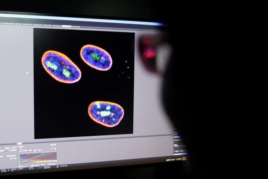 Gene therapy developed to delay ageing