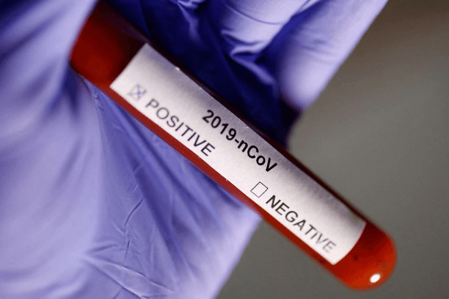 Volunteers wanted to catch Covid in the name of science