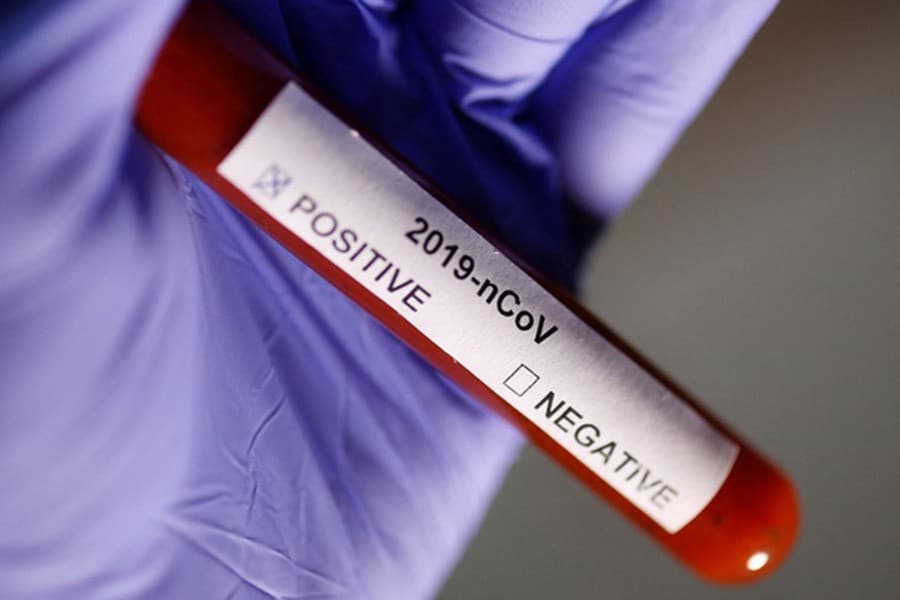 Ivermectin shows ‘antiviral effect’ against Covid