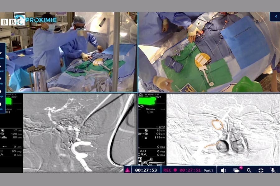 The robot surgeons and virtual surgery