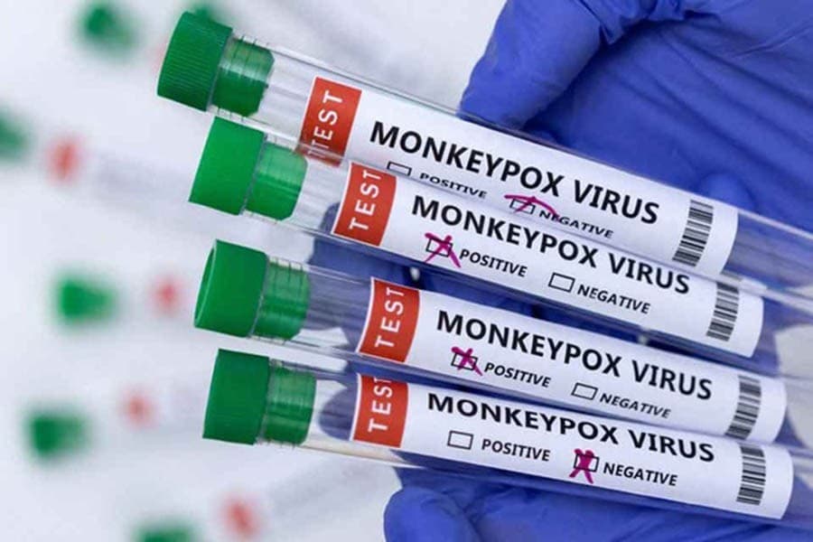 Monkeypox presents moderate risk to global public health, WHO says