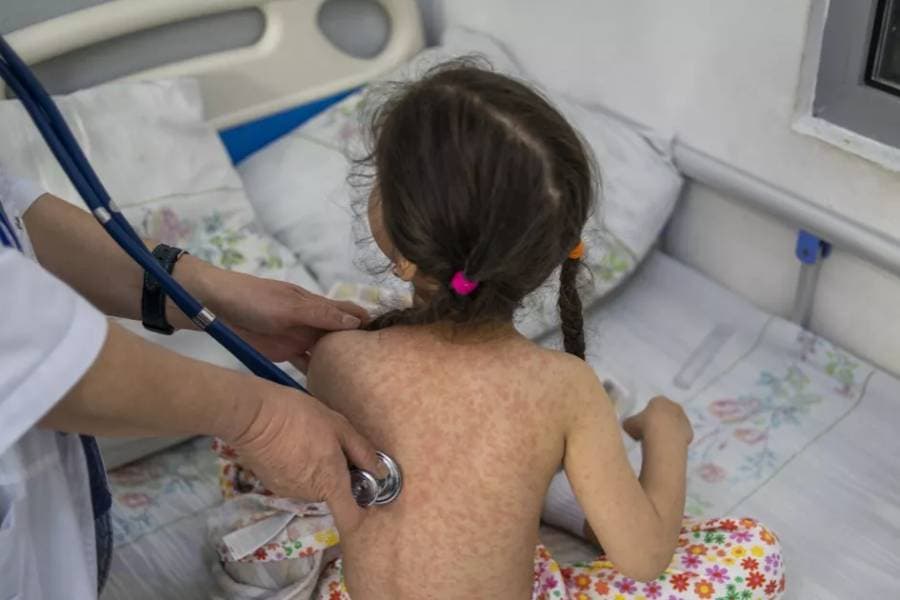 Jab management failure behind measles outbreak