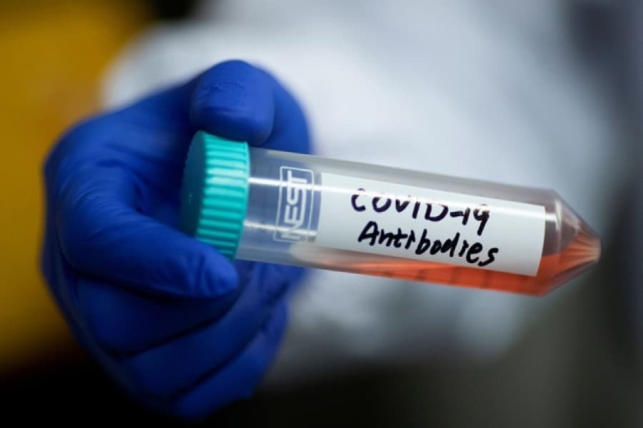 Covid antibody test: Why is the delay?